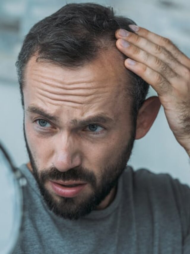 Natural DHT Blocker to Combat Male Hair Loss.